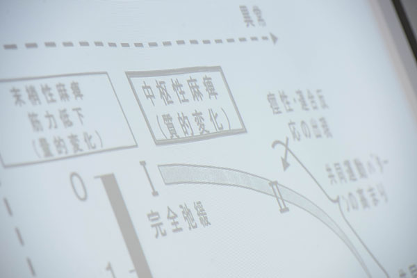 言語聴覚士に残業はある？気になる働き方について